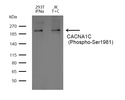 Phospho-CaV1.2 (Ser1981) Antibody in Western Blot (WB)