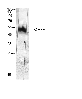 Phospho-MDM2 (Tyr394) Antibody in Western Blot (WB)