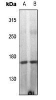 Phospho-DAPK1 (Ser308) Antibody in Western Blot (WB)
