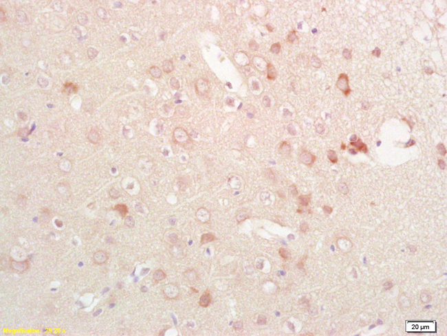 Phospho-EphB1 (Tyr928) Antibody in Immunohistochemistry (Paraffin) (IHC (P))