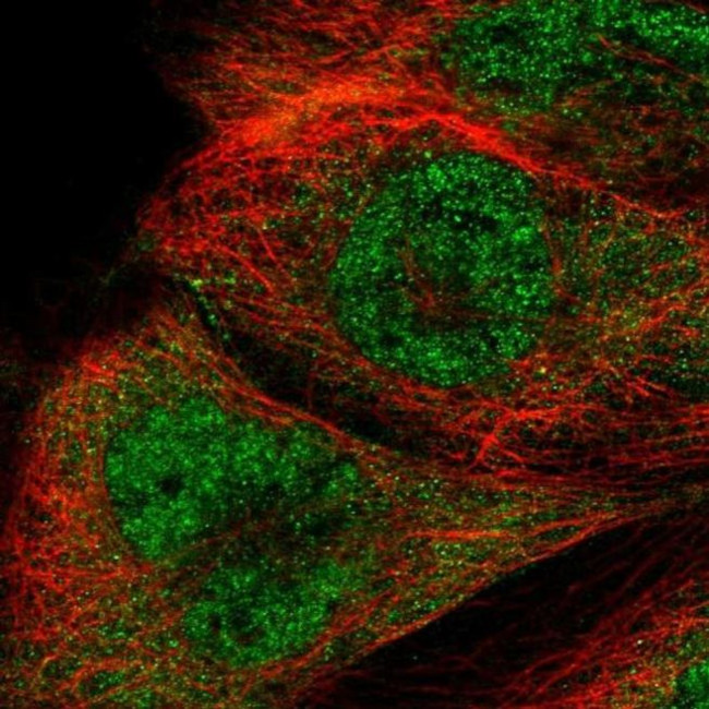 RTCB Antibody in Immunocytochemistry (ICC/IF)