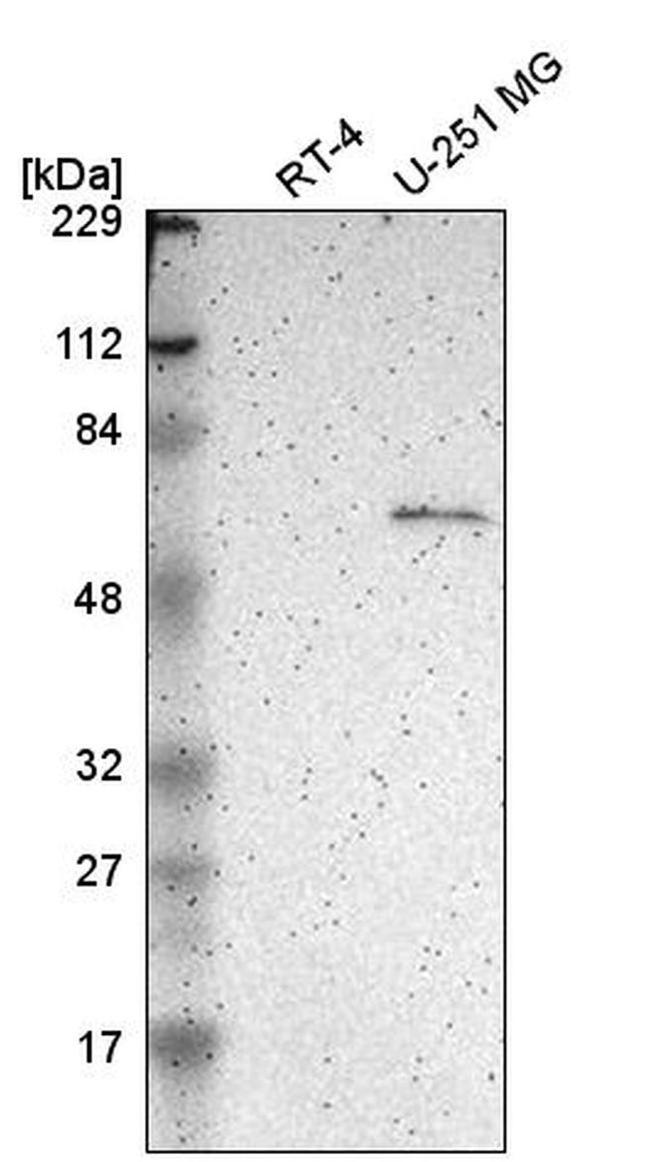 Asparagine Synthetase Antibody in Western Blot (WB)
