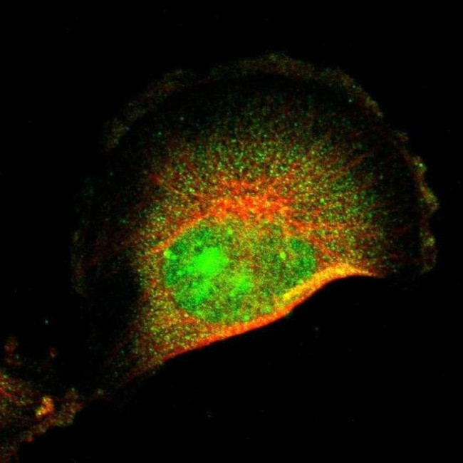 FRMD8 Antibody in Immunocytochemistry (ICC/IF)