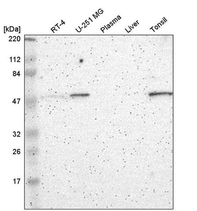 FRMD8 Antibody in Western Blot (WB)