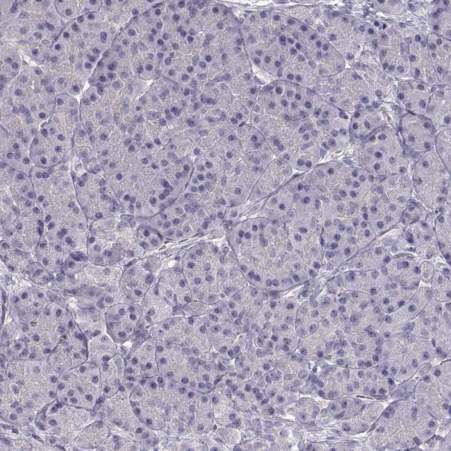 SLC18A1 Antibody in Immunohistochemistry (Paraffin) (IHC (P))