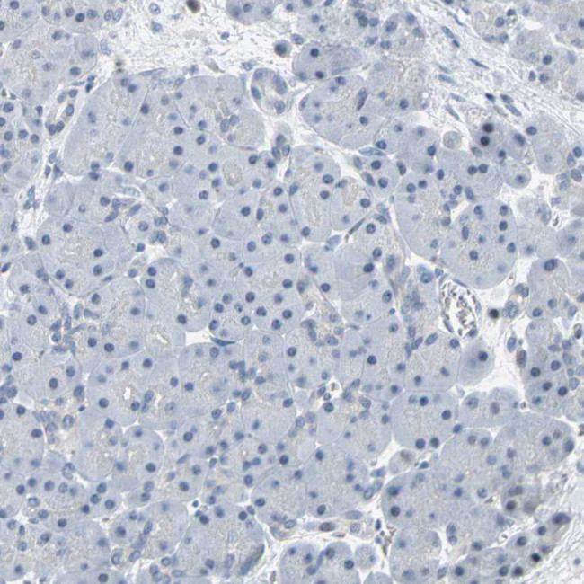 IMPG2 Antibody in Immunohistochemistry (Paraffin) (IHC (P))