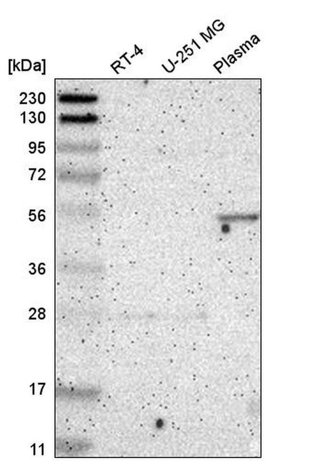 FBXL6 Antibody in Western Blot (WB)