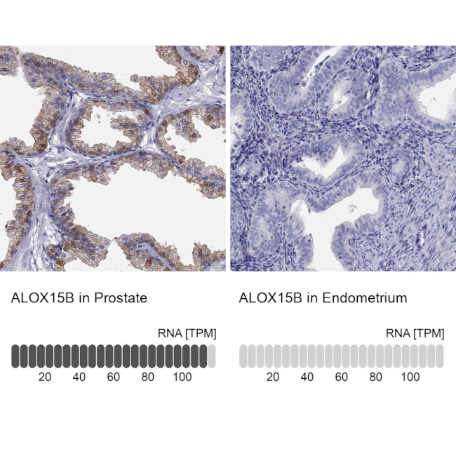 ALOX15B Antibody in Immunohistochemistry (IHC)