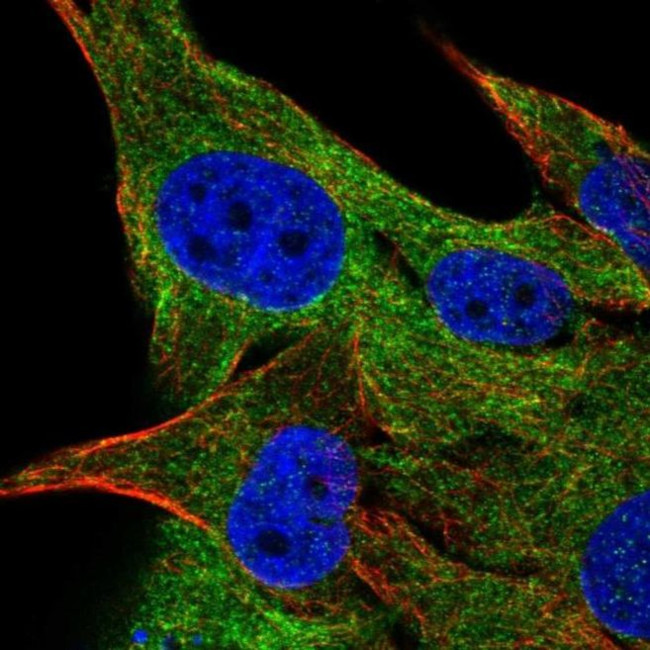 FAM134A Antibody in Immunocytochemistry (ICC/IF)