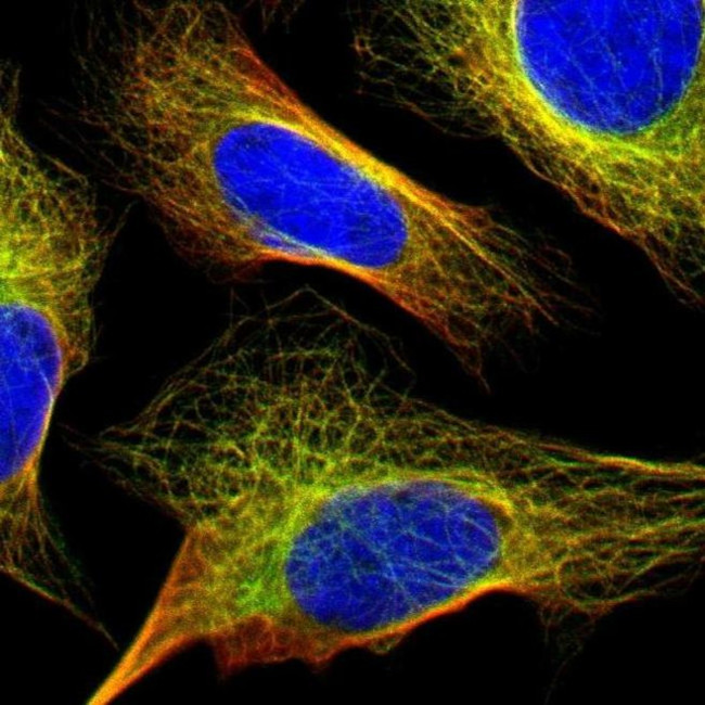 FBXO30 Antibody in Immunocytochemistry (ICC/IF)