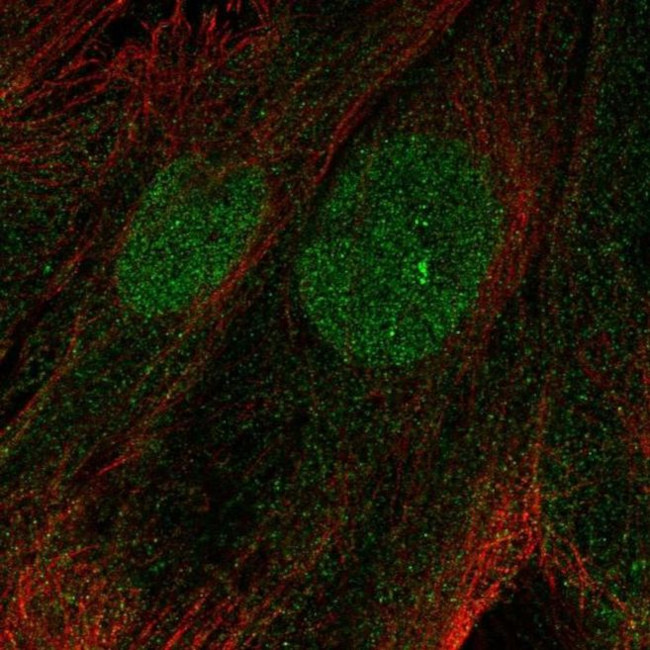 PHF11 Antibody in Immunocytochemistry (ICC/IF)