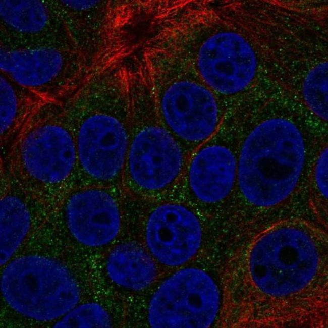 TOB2 Antibody in Immunocytochemistry (ICC/IF)