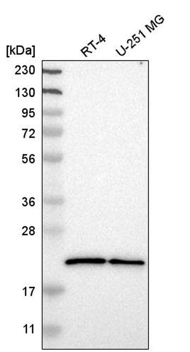 Sorcin Antibody in Western Blot (WB)