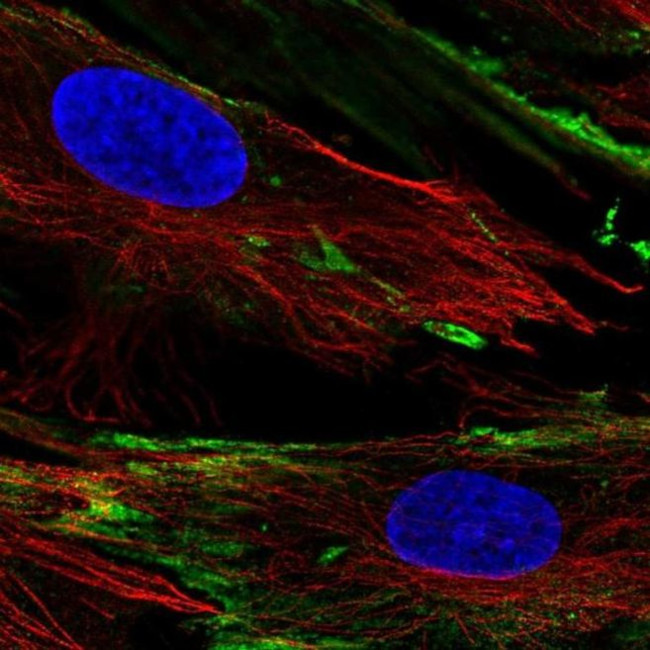 PXDC1 Antibody in Immunocytochemistry (ICC/IF)