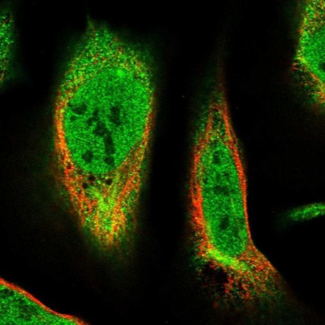 TMEM51 Antibody in Immunocytochemistry (ICC/IF)