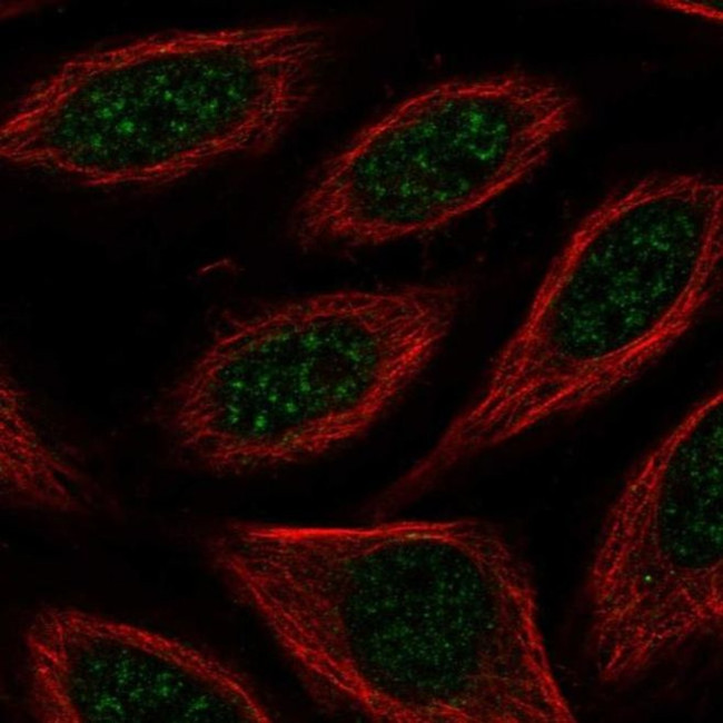 TAIP12 Antibody in Immunocytochemistry (ICC/IF)