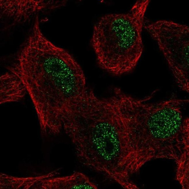 ZIP11 Antibody in Immunocytochemistry (ICC/IF)