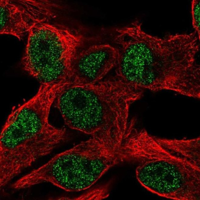 PPP1R35 Antibody in Immunocytochemistry (ICC/IF)