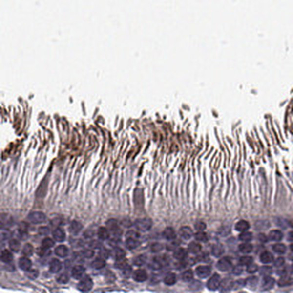 RP1L1 Antibody in Immunohistochemistry (IHC)