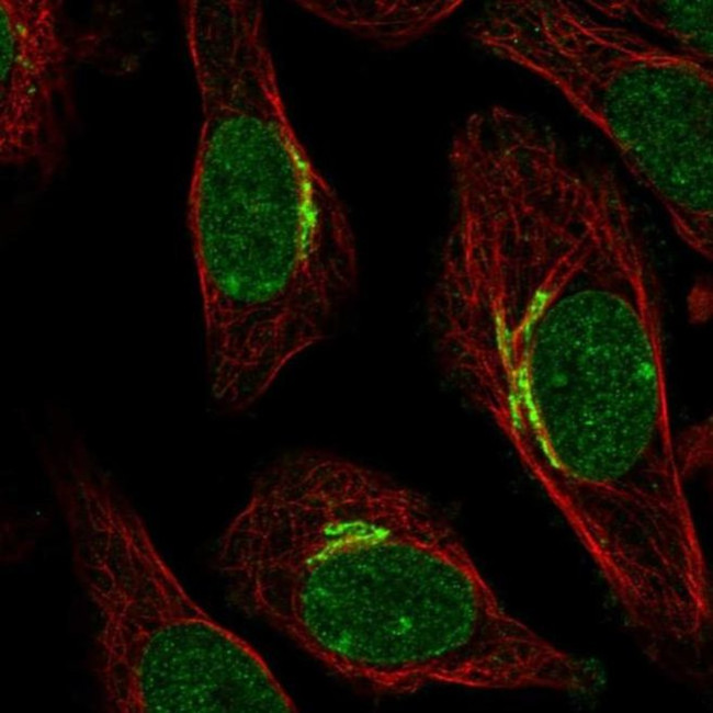 SIPA1L2 Antibody in Immunocytochemistry (ICC/IF)
