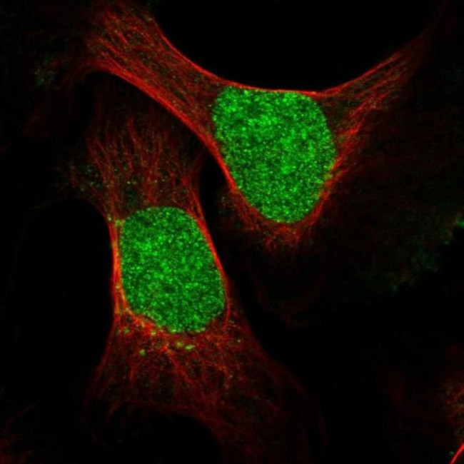 ESCO2 Antibody in Immunocytochemistry (ICC/IF)
