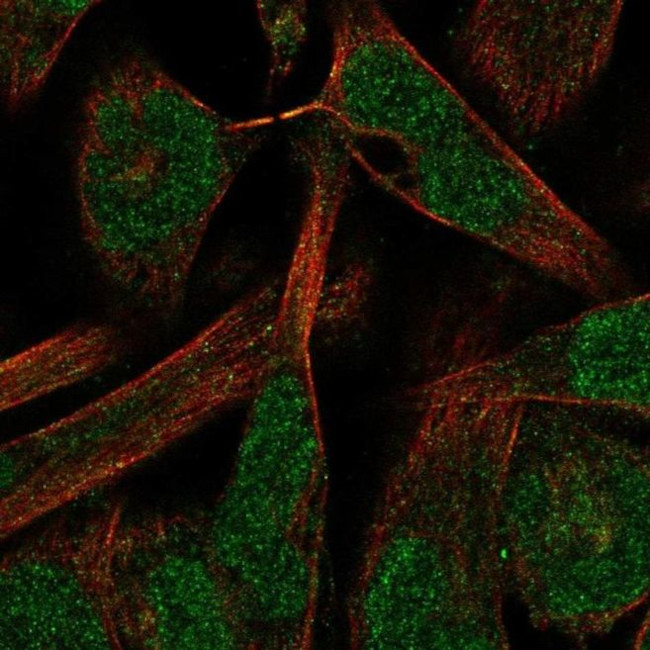 PKNOX2 Antibody in Immunocytochemistry (ICC/IF)