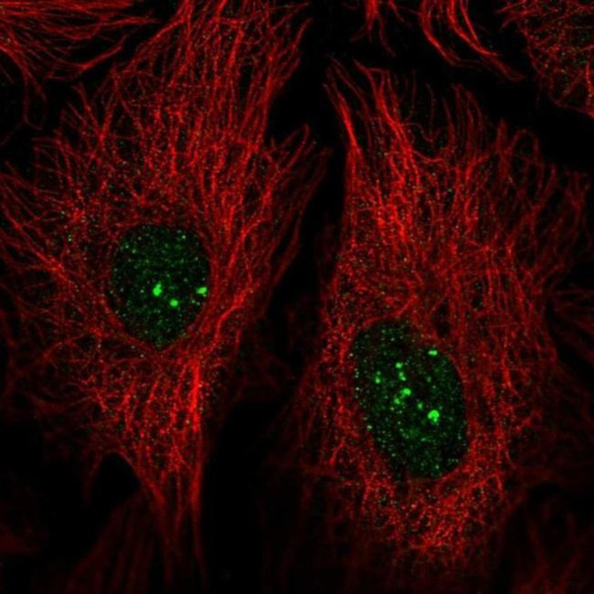 PRDM15 Antibody in Immunocytochemistry (ICC/IF)
