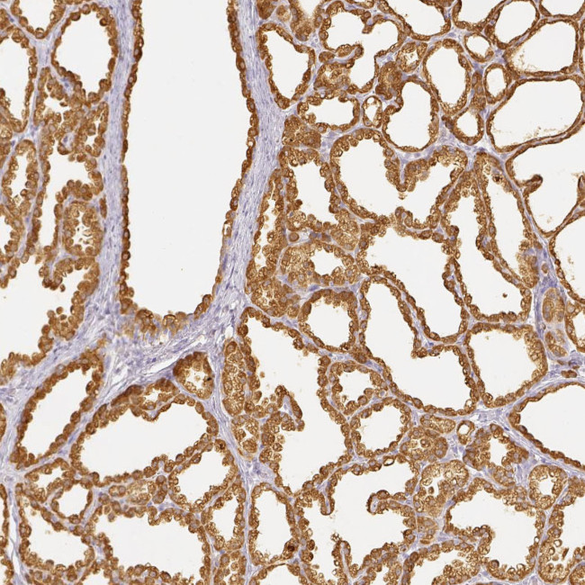 LALBA Antibody in Immunohistochemistry (Paraffin) (IHC (P))