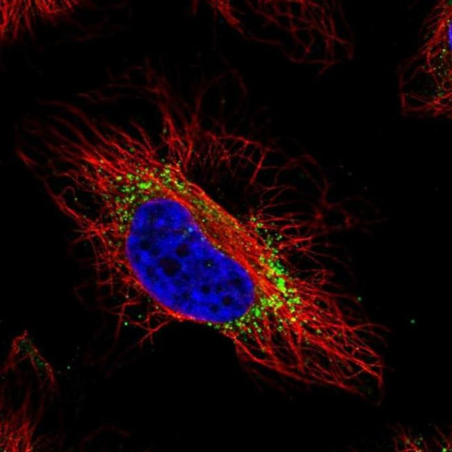 GTPBP2 Antibody in Immunocytochemistry (ICC/IF)