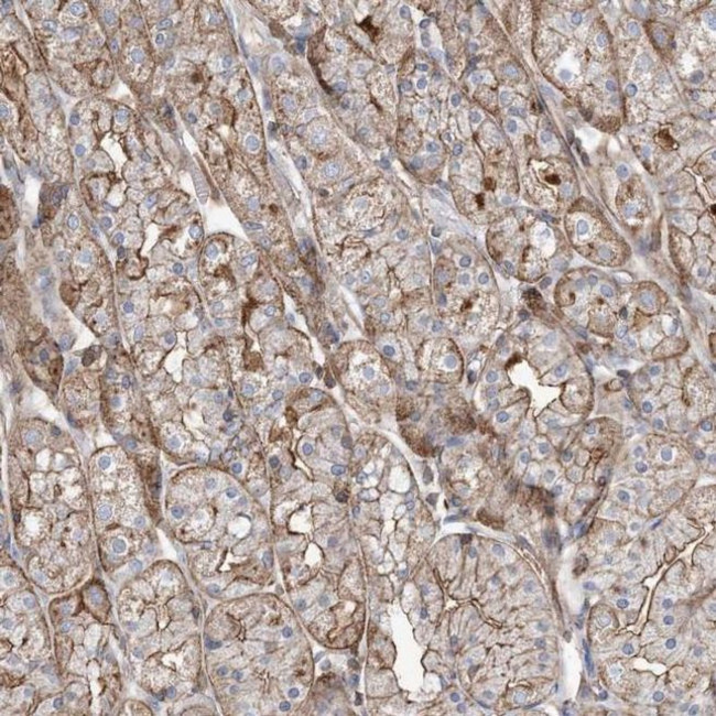PARVG Antibody in Immunohistochemistry (IHC)