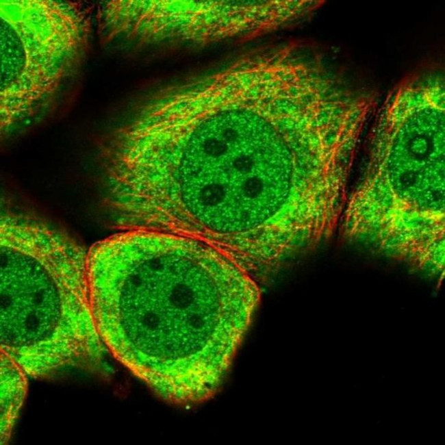 MYO5C Antibody in Immunocytochemistry (ICC/IF)