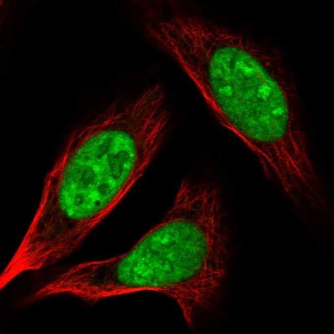 AK6 Antibody in Immunocytochemistry (ICC/IF)