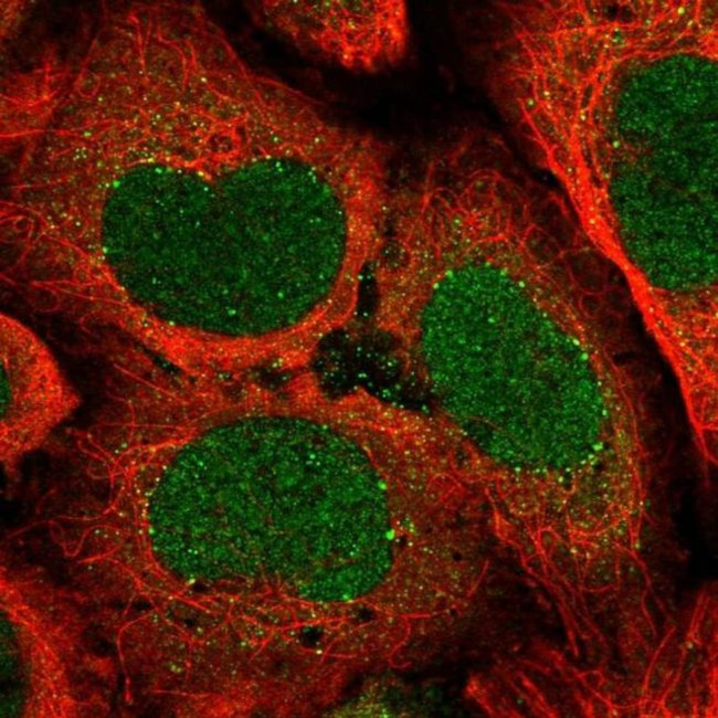 ATP6V1A Antibody in Immunocytochemistry (ICC/IF)