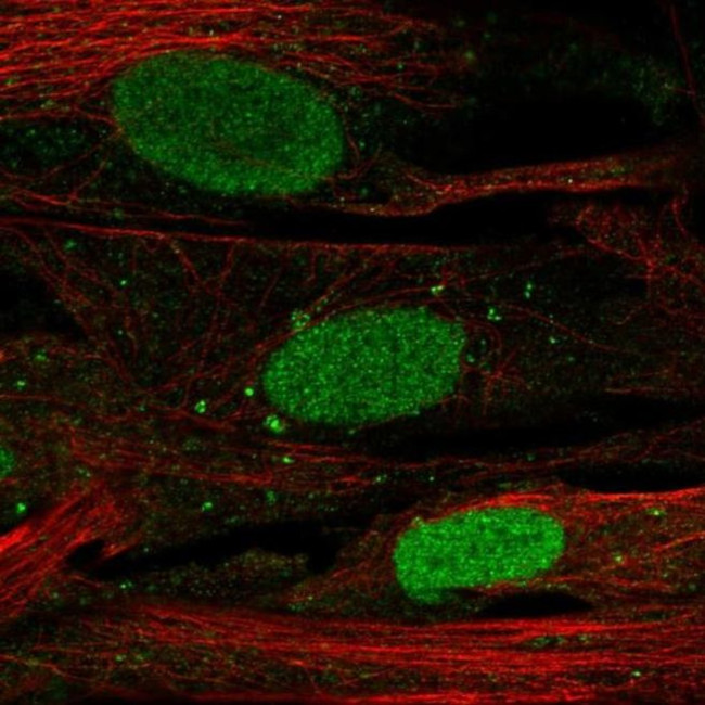 SHOX Antibody in Immunocytochemistry (ICC/IF)