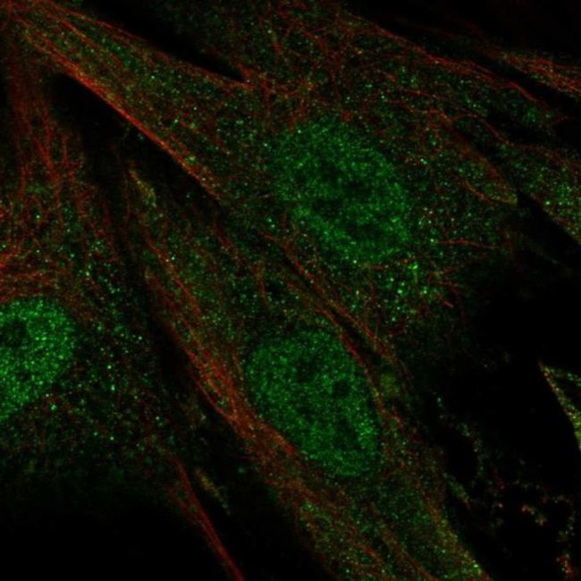 CERKL Antibody in Immunocytochemistry (ICC/IF)