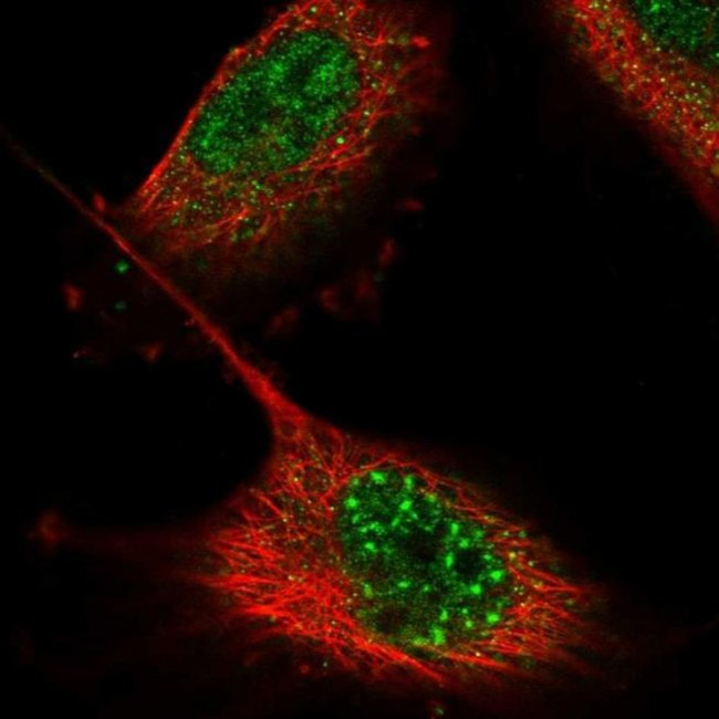 ZNF551 Antibody in Immunocytochemistry (ICC/IF)