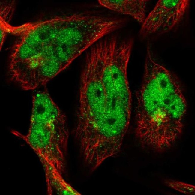 OTUD1 Antibody in Immunocytochemistry (ICC/IF)