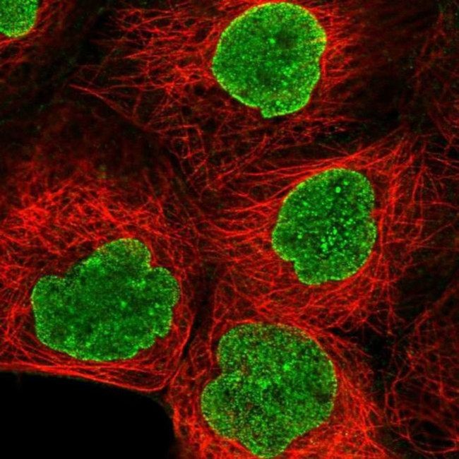 AMPD3 Antibody in Immunocytochemistry (ICC/IF)