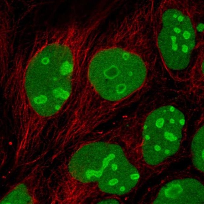 EMG1 Antibody in Immunocytochemistry (ICC/IF)