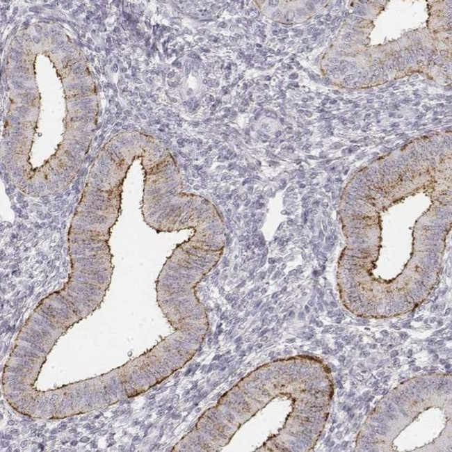 KRT84 Antibody in Immunohistochemistry (IHC)