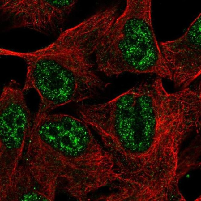 TMEM101 Antibody in Immunocytochemistry (ICC/IF)