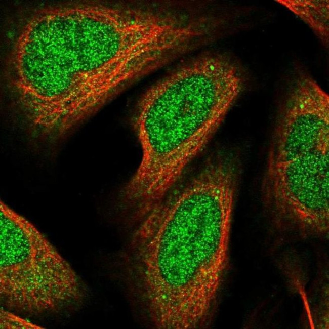 RhoBTB1 Antibody in Immunocytochemistry (ICC/IF)