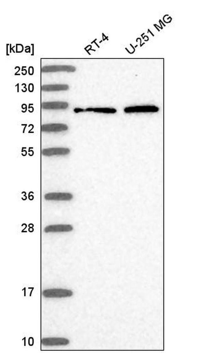 RhoBTB1 Antibody in Western Blot (WB)