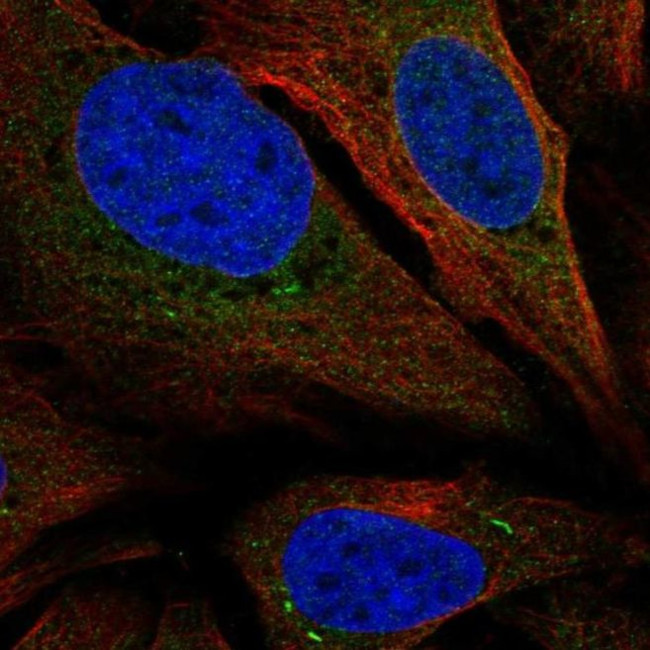 TMEM66 Antibody in Immunocytochemistry (ICC/IF)