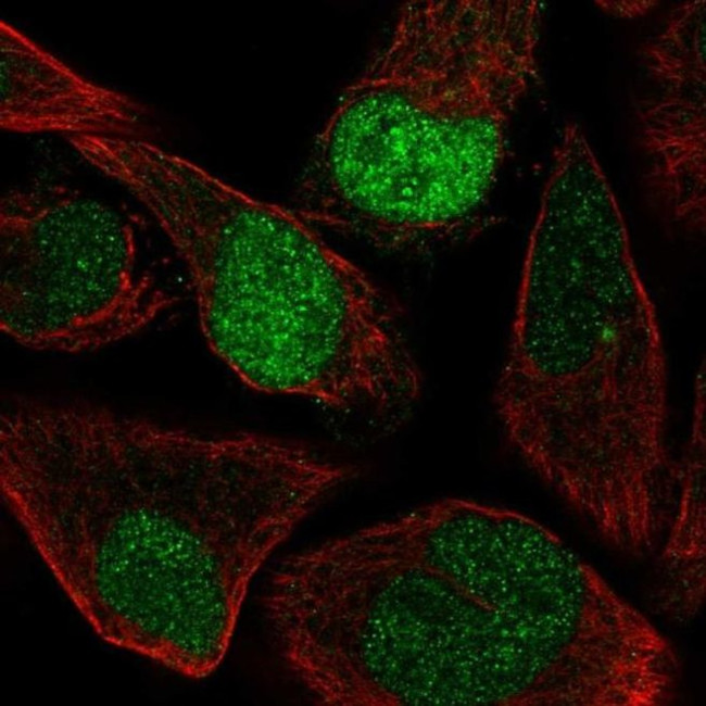 AQR Antibody in Immunocytochemistry (ICC/IF)