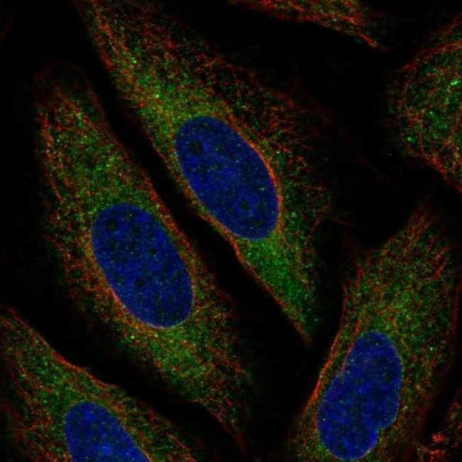TEB4 Antibody in Immunocytochemistry (ICC/IF)