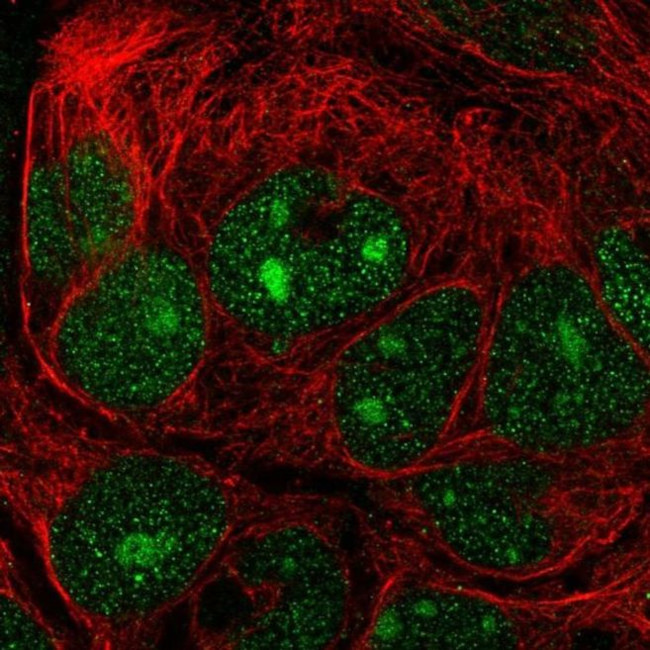 NIP7 Antibody in Immunocytochemistry (ICC/IF)