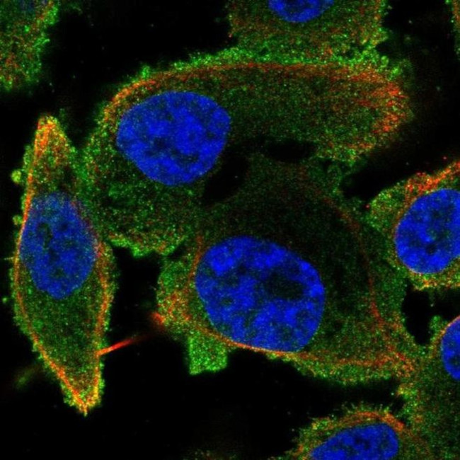PLCB2 Antibody in Immunocytochemistry (ICC/IF)