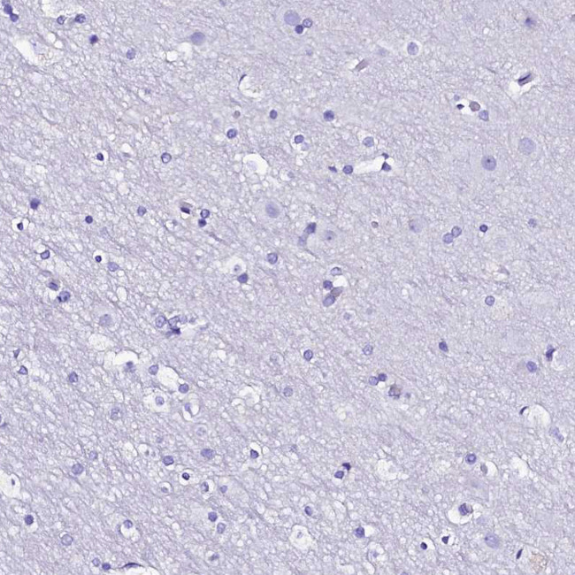 RBP3 Antibody in Immunohistochemistry (Paraffin) (IHC (P))