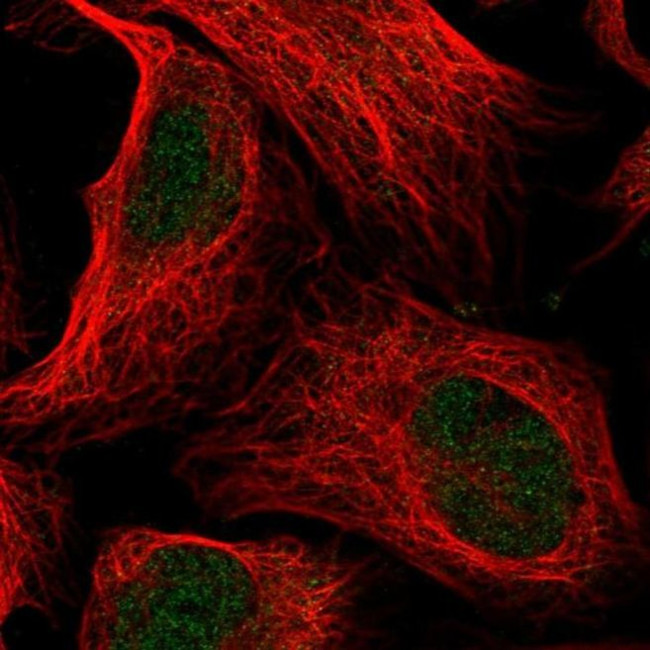 ANKRD11 Antibody in Immunocytochemistry (ICC/IF)